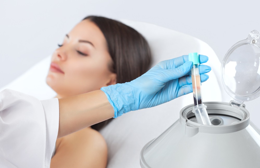 PRP Procedure