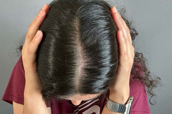 Hair Restoration With PRP Before & After Image