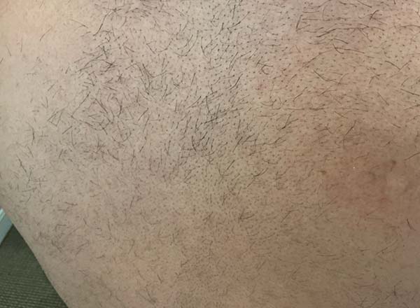 Picoway Before & After Image