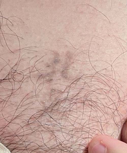 Picoway Before & After Image