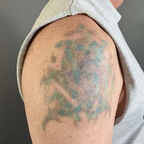 Picoway Before & After Image