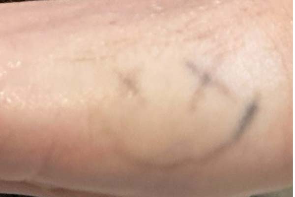 Picoway Before & After Image